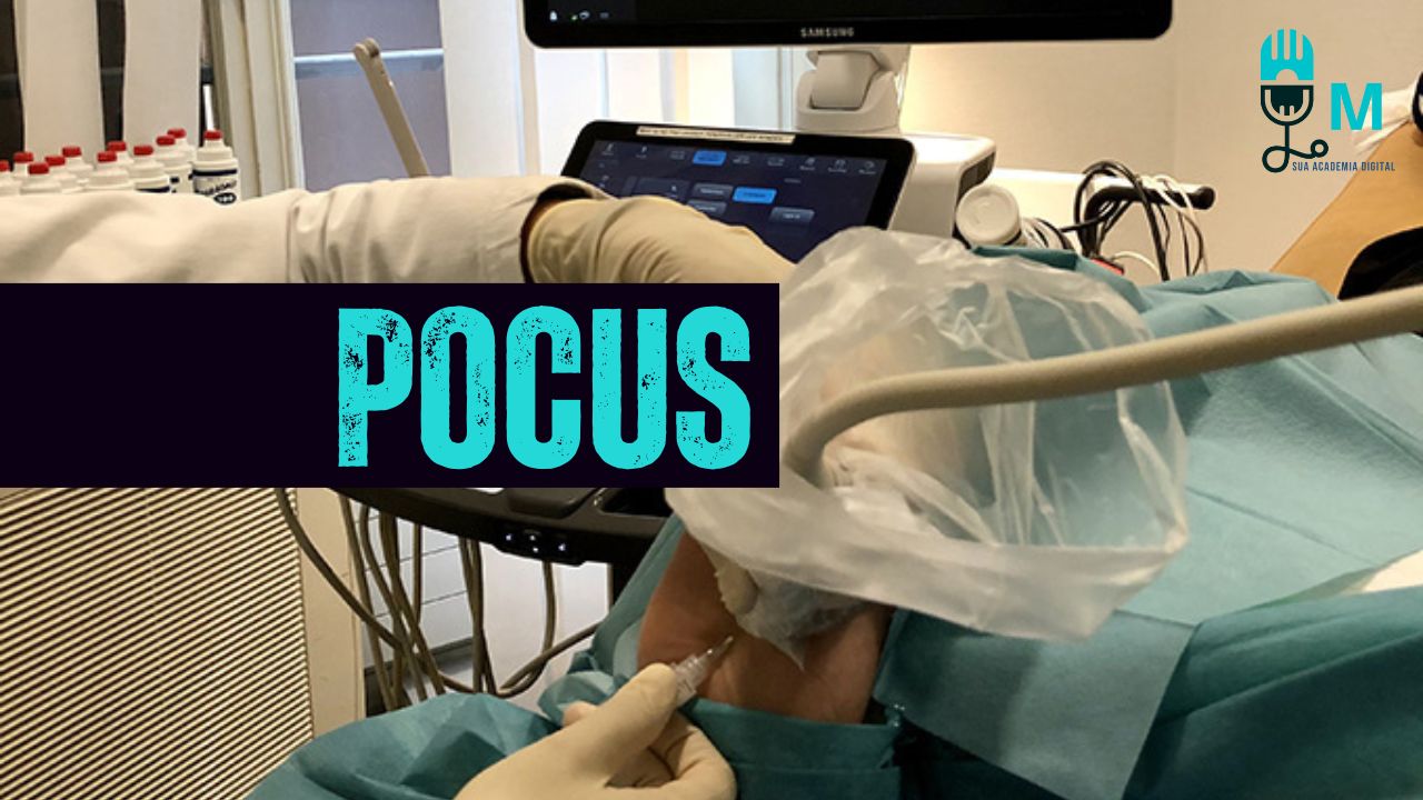 A Tempestade Perfeita: POCUS no Cuidado do Paciente Crítico em Terapia Intensiva