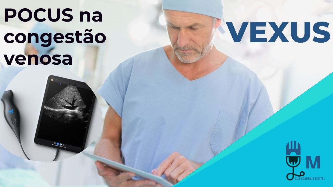 Congestão Venosa: Descubra a Verdade que a VCI Não Conta, Mas o Protocolo VExUS Revela!