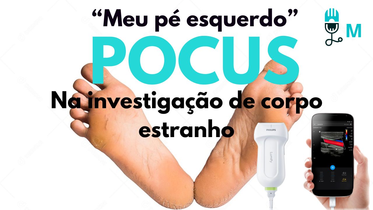‘Meu Pé Esquerdo”: POCUS na Investigação de Corpo Estranho